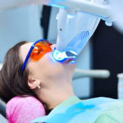 sbiancamento denti